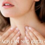 cách làm nhỏ bướu cổ