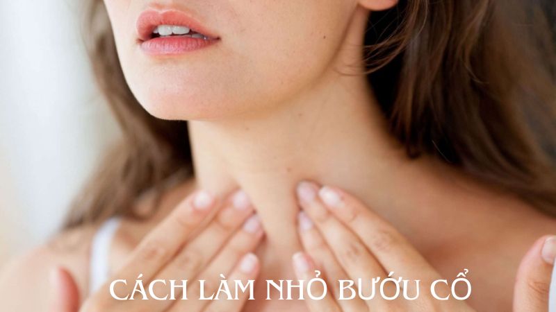 Cách làm nhỏ bướu cổ: Giải pháp toàn diện cho sức khỏe tuyến giáp